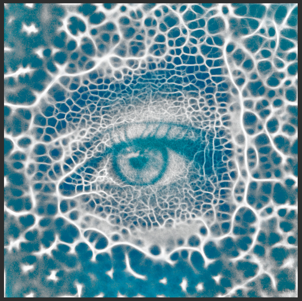 eye